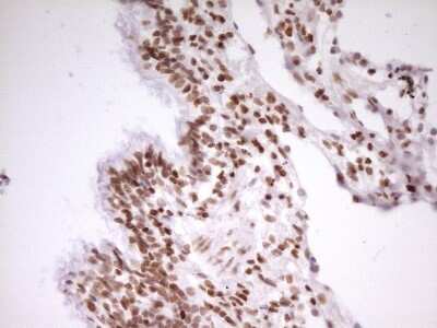 Immunohistochemistry: SP110 Antibody (OTI4C1) [NBP2-45919]