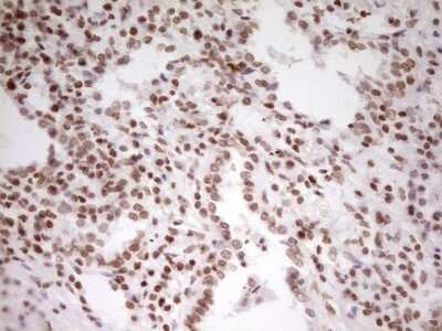 Immunohistochemistry: SP110 Antibody (OTI4C1) [NBP2-45919]
