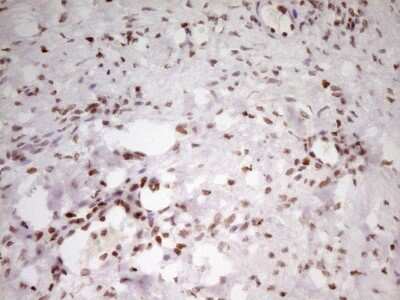 Immunohistochemistry: SP110 Antibody (OTI4C1) [NBP2-45919]