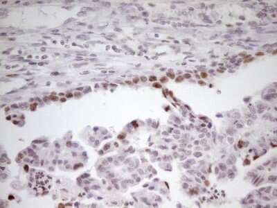 Immunohistochemistry: SP110 Antibody (OTI4C1) [NBP2-45919]