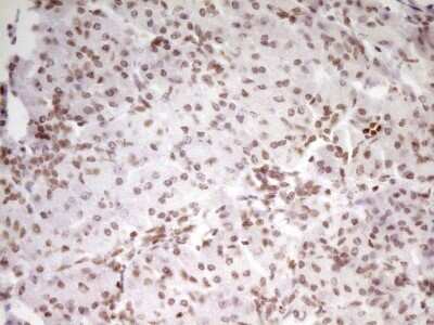 Immunohistochemistry: SP110 Antibody (OTI4C1) [NBP2-45919]