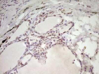 Immunohistochemistry: SP110 Antibody (OTI4C1) [NBP2-45919]