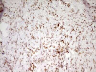 Immunohistochemistry: SP110 Antibody (OTI4C1) [NBP2-45919]