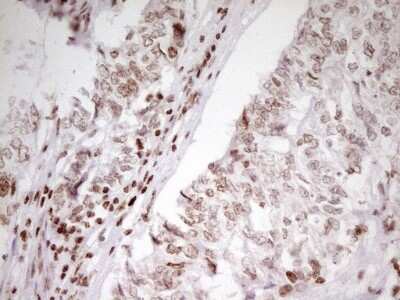 Immunohistochemistry: SP110 Antibody (OTI4C1) [NBP2-45919]
