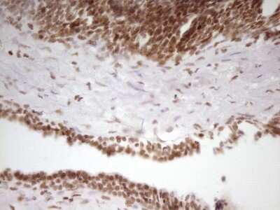 Immunohistochemistry: SP110 Antibody (OTI4C1) [NBP2-45919]