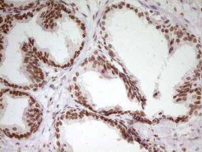 Immunohistochemistry: SP110 Antibody (OTI4C1) [NBP2-45919]