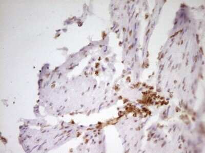 Immunohistochemistry: SP110 Antibody (OTI4C1) [NBP2-45919]