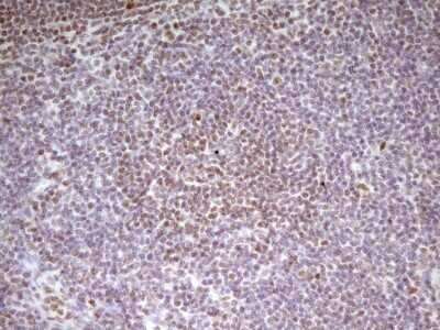 Immunohistochemistry: SP110 Antibody (OTI4C1) [NBP2-45919]
