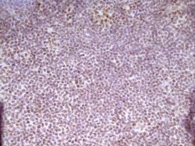 Immunohistochemistry: SP110 Antibody (OTI4C1) [NBP2-45919]