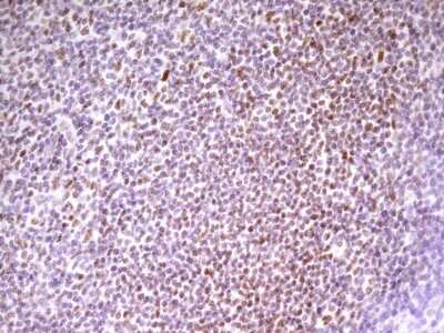 Immunohistochemistry: SP110 Antibody (OTI4C1) [NBP2-45919]