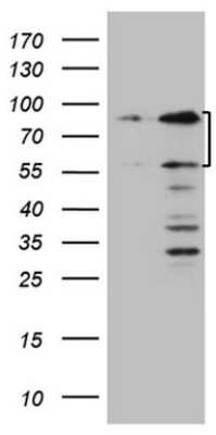 Western Blot: SP110 Antibody (OTI4C1) [NBP2-45919]