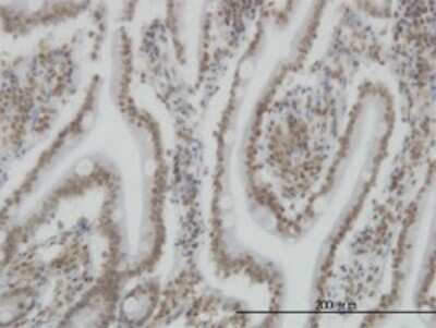 Immunohistochemistry-Paraffin: SP110 Antibody (8C8) [H00003431-M01]