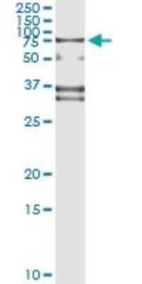 Immunoprecipitation: SP110 Antibody (8C8) [H00003431-M01]
