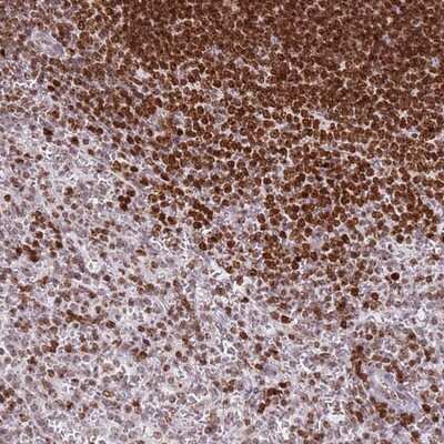 Immunohistochemistry-Paraffin: SP110 Antibody [NBP1-92426]