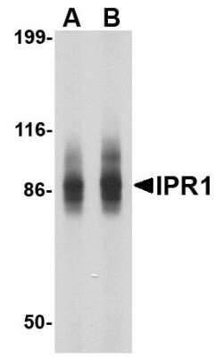 Western Blot: SP110 AntibodyBSA Free [NBP1-76385]