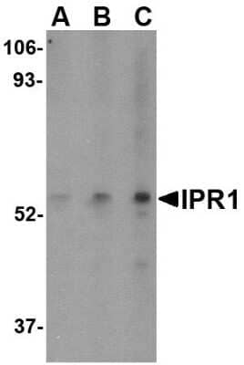 Western Blot: SP110 AntibodyBSA Free [NBP1-77316]