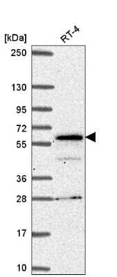 Western Blot: SP110 Antibody [NBP2-56189]