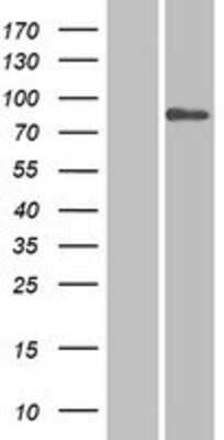 Western Blot: SP110 Overexpression Lysate [NBP2-09802]