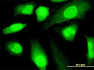 Immunocytochemistry/ Immunofluorescence: SP140 Antibody (3F9) [H00011262-M07]