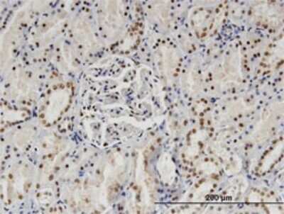 Immunohistochemistry-Paraffin: SP140 Antibody (3F9) [H00011262-M07]