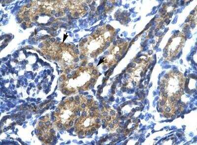Immunohistochemistry-Paraffin: SP140 Antibody [NBP1-80009]