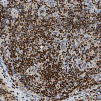 Immunohistochemistry-Paraffin: SP140 Antibody [NBP1-81275]