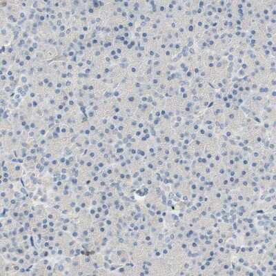 SP140 Antibody - BSA Free (NBP1-81275) by Novus, Part of Bio-Techne