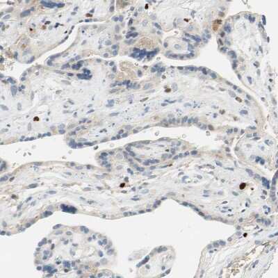 Immunohistochemistry-Paraffin: SP140 Antibody [NBP1-81275]