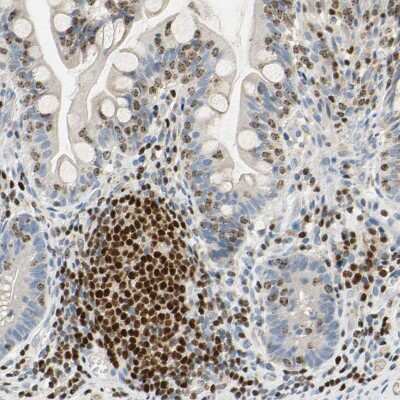 Immunohistochemistry-Paraffin: SP140 Antibody [NBP1-81275]