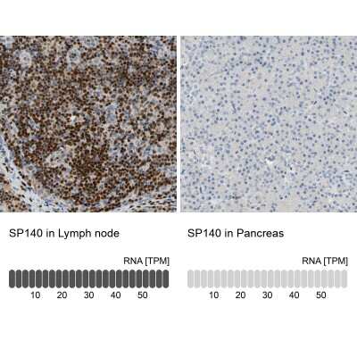 Immunohistochemistry-Paraffin: SP140 Antibody [NBP1-81275]