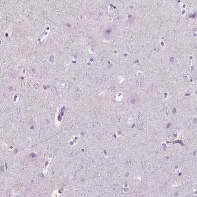 Immunohistochemistry-Paraffin: SP140 Antibody [NBP2-49517]