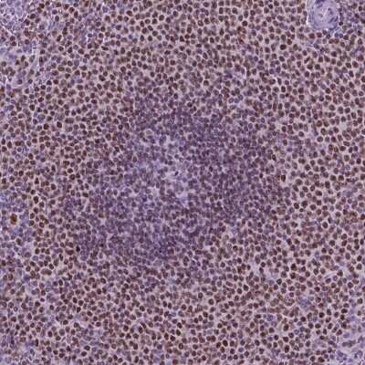 Immunohistochemistry-Paraffin: SP140 Antibody [NBP2-49517]
