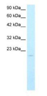 Western Blot: SP140 Antibody [NBP1-80009]