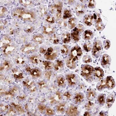 Immunohistochemistry-Paraffin: SP140L Antibody [NBP2-49197]