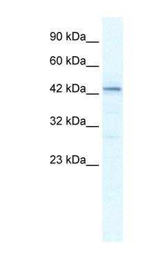 Western Blot: SP140L Antibody [NBP1-80140]