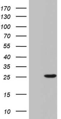 Western Blot: SP17 Antibody (OTI2G6) [NBP2-45920]