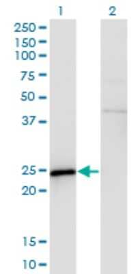 Western Blot: SP17 Antibody (3B6) [H00053340-M03]