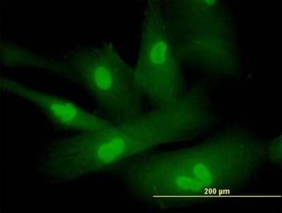 Immunocytochemistry/ Immunofluorescence: SP17 Antibody [H00053340-B01P]