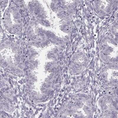 Immunohistochemistry-Paraffin: SP17 Antibody [NBP1-85409]