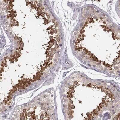 Immunohistochemistry-Paraffin: SP17 Antibody [NBP1-85409]
