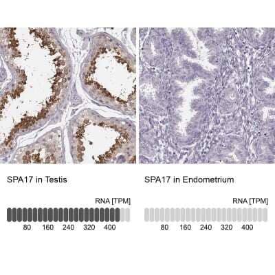 Immunohistochemistry-Paraffin: SP17 Antibody [NBP1-85409]