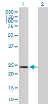 Western Blot: SP17 Antibody [H00053340-B01P]