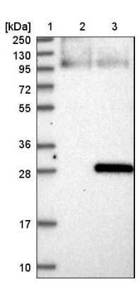 Western Blot: SP17 Antibody [NBP1-85409]