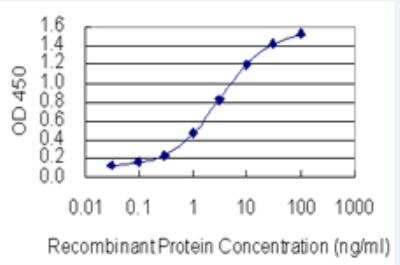 ELISA: SP2 Antibody (5D3) [H00006668-M01-100ug]