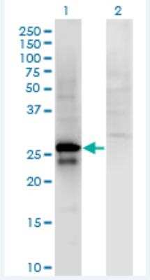 Western Blot: SP2 Antibody (5D3) [H00006668-M01-100ug]