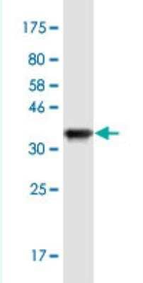 Western Blot: SP2 Antibody (5D3) [H00006668-M01-100ug]