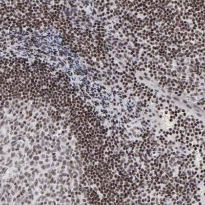 Immunohistochemistry-Paraffin: SP2 Antibody [NBP1-83054]