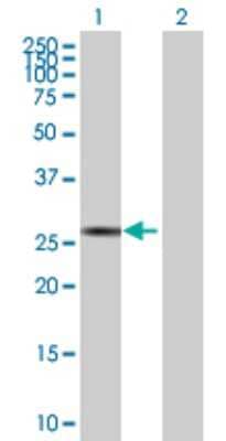 Western Blot: SP2 Antibody [H00006668-B01P]