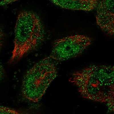 Immunocytochemistry/ Immunofluorescence: SP4 Antibody [NBP2-31983]