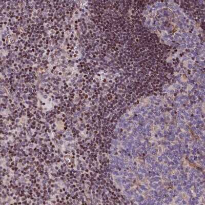 Immunohistochemistry-Paraffin: SP4 Antibody [NBP2-31983]